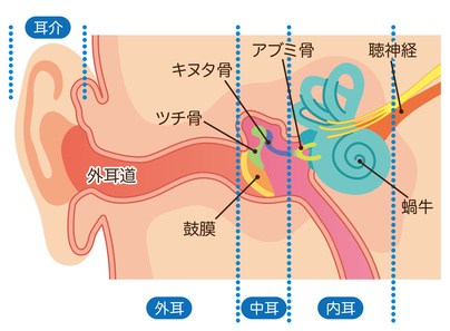 真珠腫性中耳炎の原因は？